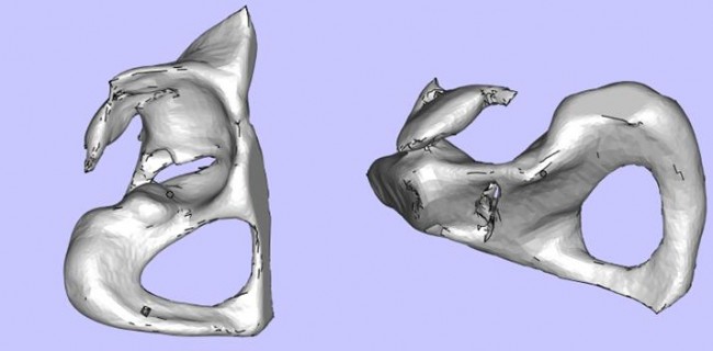 Case 1_1