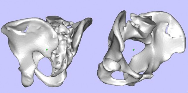 Case 2_1