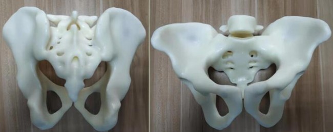 Case 2_2
