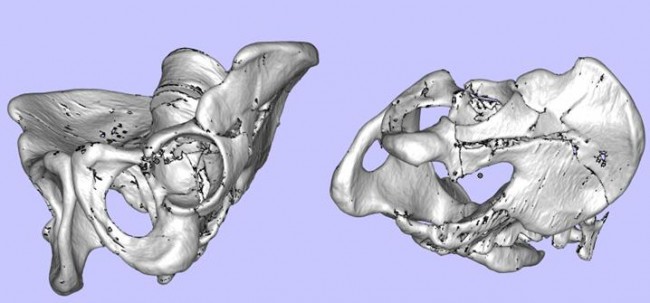 Case 4_1