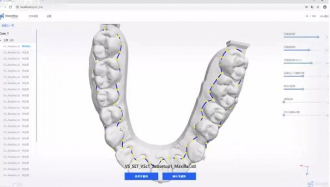 Heygear_Dental4