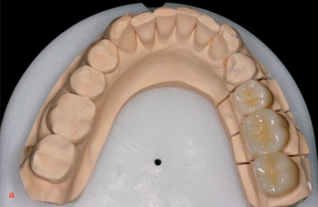 Dental_TCT_2