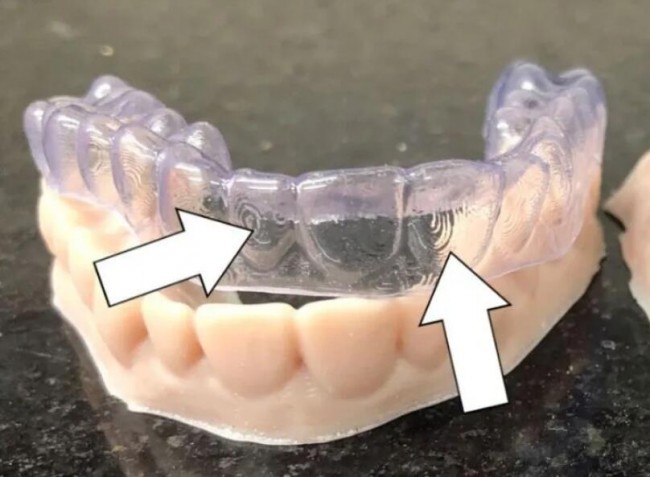 Dental_Fast track
