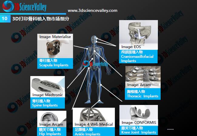 Whitepaper_Orthopedic Implant_10