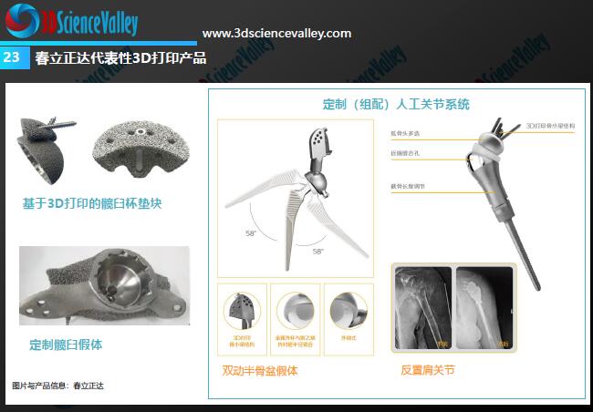 Whitepaper_Orthopedic Implant_23