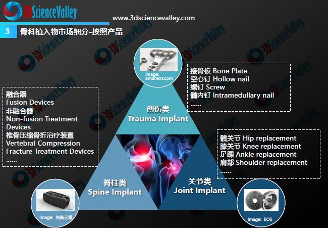 Whitepaper_Orthopedic Implant_3