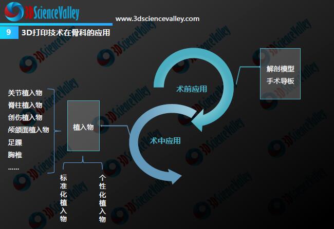 Whitepaper_Orthopedic Implant_9