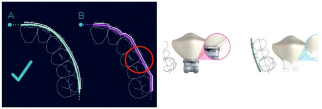 Dental_LightForce_2