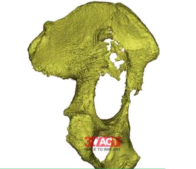 orthopedics-1