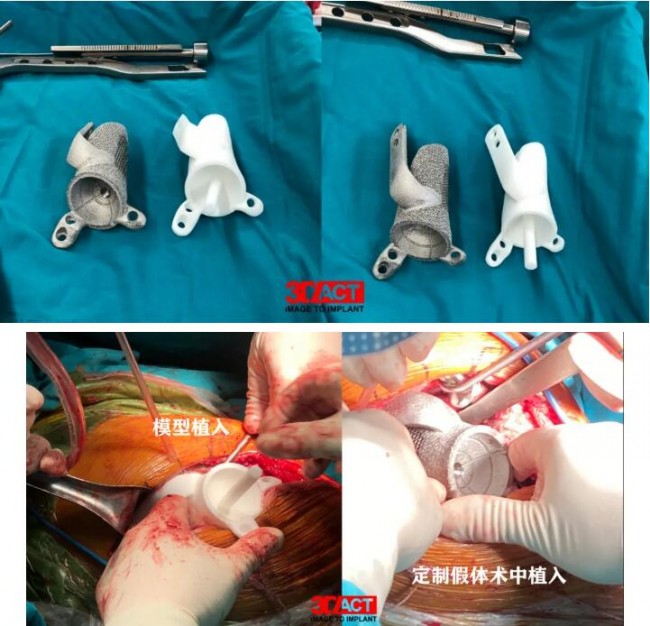 orthopedics3