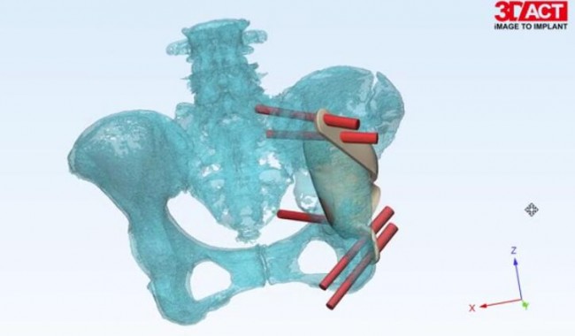orthopedics_2