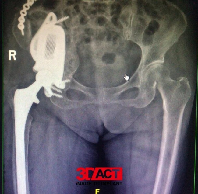 orthopedics_4