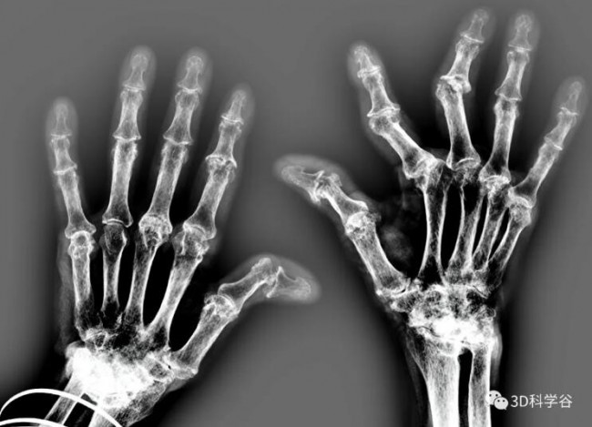 Fraunhofer IAPT_bone