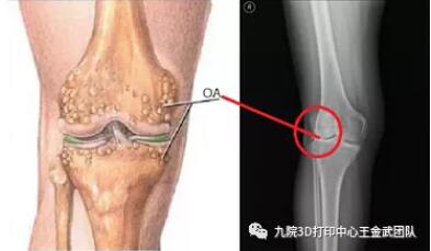 knee_3