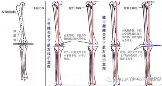 knee_4