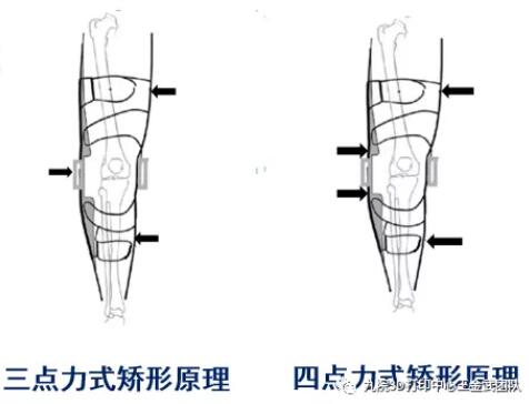 knee_5