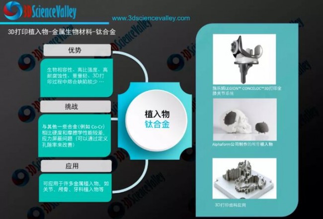 Implants_Ti_Valley