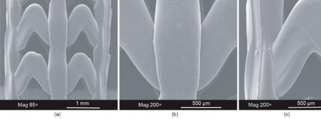 Article_stents_20