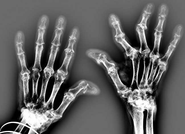 Finger_Fraunhofer_2
