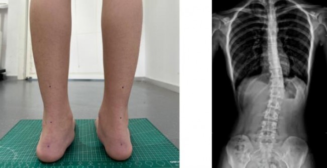 foot_1