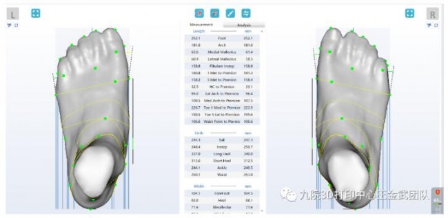 foot_3