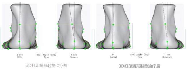 foot_5