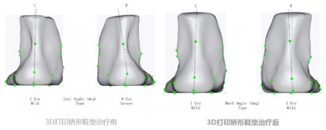 foot_7