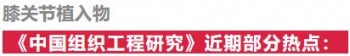 膝关节