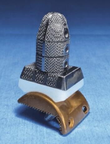 article_Metal_9