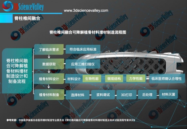 valley 脊柱