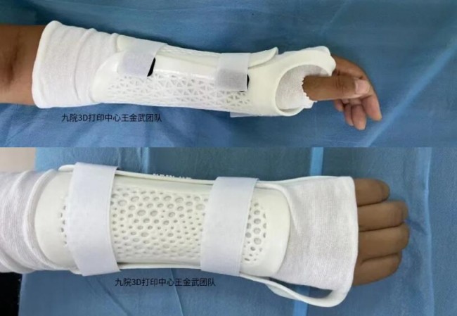 arm_1
