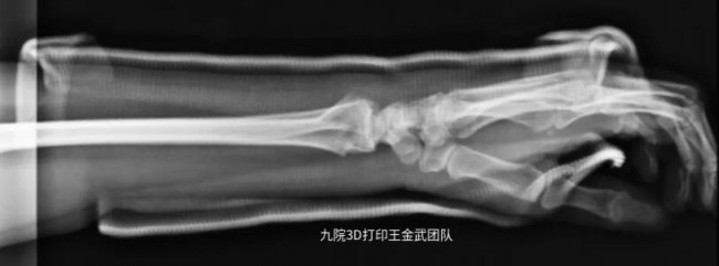 arm_3