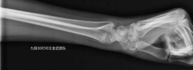 arm_4