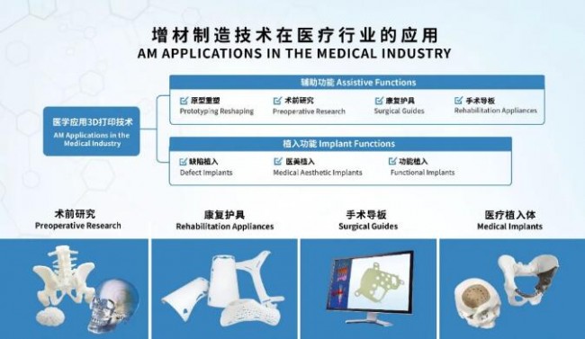 uniontech_TCT_medical